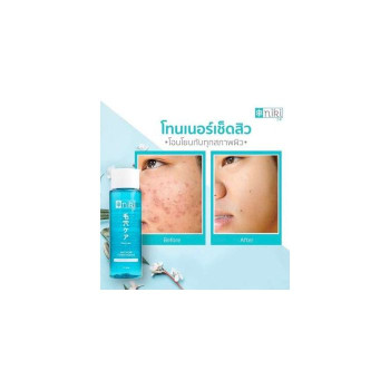 Niki Niki Toner (Twin Pack) Салфетки для удаления прыщей для лица без спирта Протрите черные точки, забитые прыщи, сузьте поры.