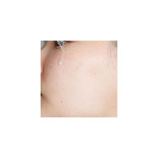 100% подлинный KIEHLS CLEARLY CORRECTIVE DARK SPOT SOLUTION 4 мл четко корректирующей сыворотки с раствором темных пятен