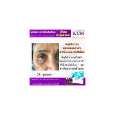 KCM Water Eyes