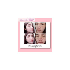 Anna Bee Gold Основная компания: Pure White Toner Toner Pure White. Растворите пятно на точке. Отрегулируйте кожу, чтобы она была гладкой, а также подавите выработку пигмента меланина, уменьшите темные пятна, веснушки, сделайте вид блеклым.