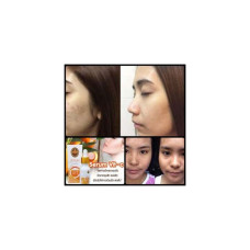 Best Serum Vitamin C Сыворотка для лица Arbutina Serum Whitening Vit C 15 мл. Сыворотка для ухода за кожей. Для тех, у кого проблемы с акне, шрамы от угревой сыпи, черные точки, покраснения от прыщей, кожа выглядит блеклой, молодой и сглаживает поры.