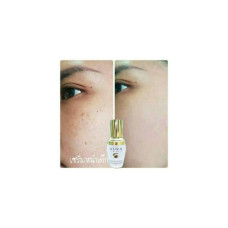 100% подлинная сыворотка Aura Rich Serum 20 мл.