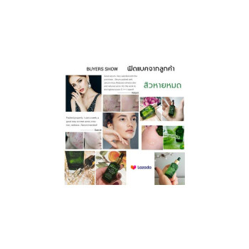 ГОРЯЧИЕ ПРОДАЖИ ПРОСМОТР Acne BREYLEE Acne Serum Acne Treatment Cream 17ml Уменьшает прыщи Улучшает состояние жирной кожи Вернуть коже гладкость. Крем от прыщей, Крем от прыщей, Гель от прыщей, Гель от прыщей, Крем для удаления прыщей, Крем для лица, Крем